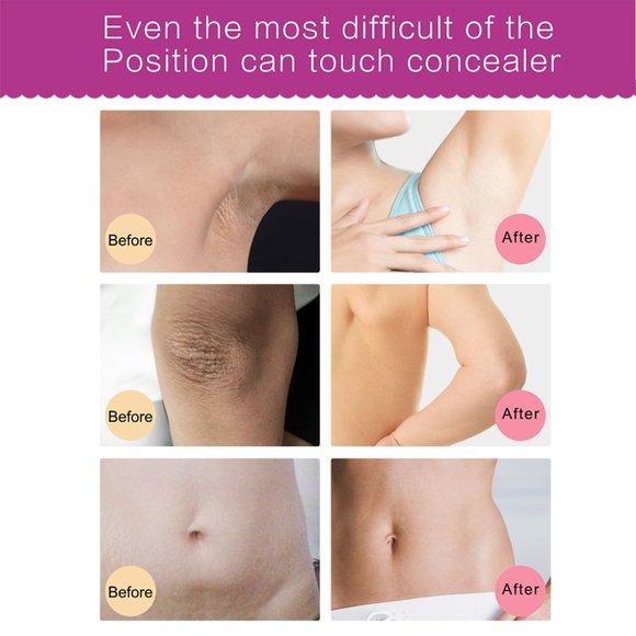 Intimate Bleaching Cream - Picture 3 of 6